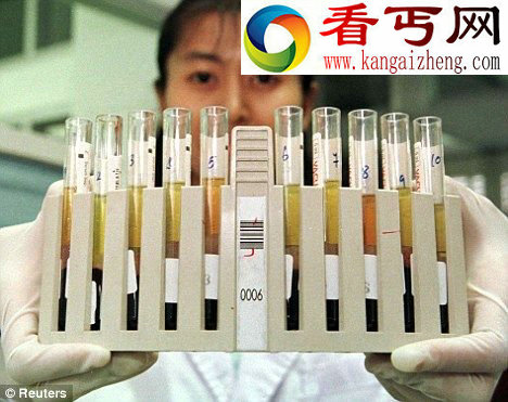 先驱传统的抗病毒治疗也能控制艾滋病毒感染,但却无法清除隐藏在免疫系统的白细胞的隐藏区里的病毒。 美国研制艾滋病疫苗 有望终生控制病毒感染