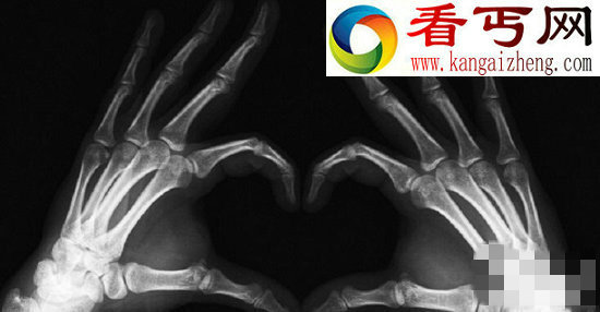 人类史上五大意外发现竟改变全世界