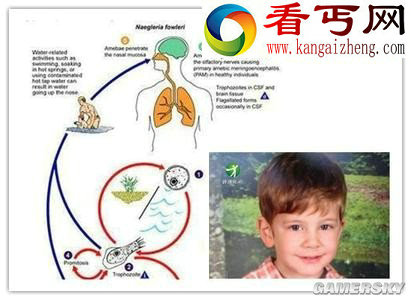 美国饮用水惊现致命“食脑虫” 可吞噬脑细胞
