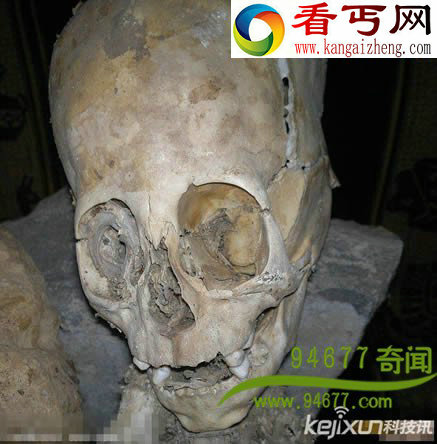 疑似外星人的巨头干尸 外星或存智慧生物