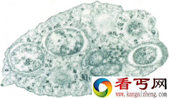 一奇特细菌可抑制寄居体生育雄性后代