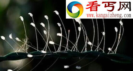 世界上最神奇的花，优昙婆罗花(不受空间限制生长)