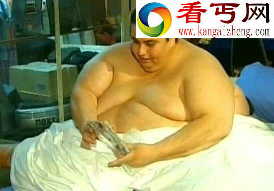 世界上最胖的男人,曼努埃尔·乌里韦597公斤(已去世)