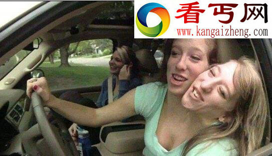 世界上最罕见的双头人，阿比盖尔和布列塔妮(想结婚)