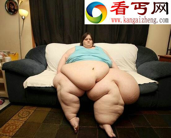 世界上最胖的女人,罗莎莉·布拉德福德(544公斤)