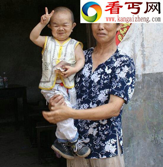 世界最矮的人,能拿公鸡当坐骑(54.6厘米)