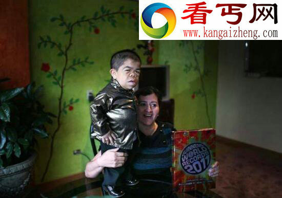 世界最矮的人,能拿公鸡当坐骑(54.6厘米)