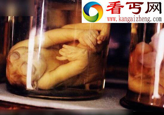 世界上最恐怖的博物馆,美国费城马特博物馆(重口味)