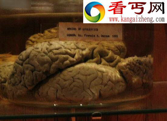 世界上最恐怖的博物馆,美国费城马特博物馆(重口味)