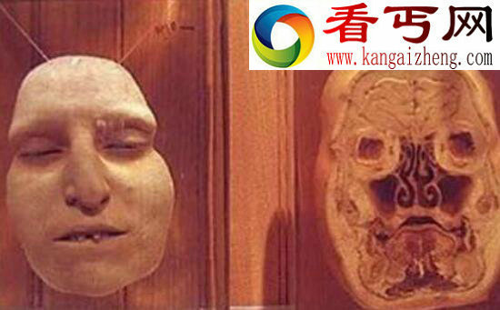 世界上最恐怖的博物馆,美国费城马特博物馆(重口味)