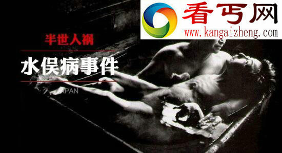 日本水俣病事件，人类史上最严重的汞中毒事件