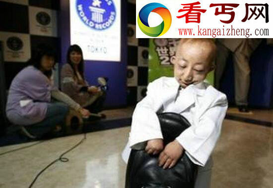 世界上最小的人，内蒙古人何平平（仅74.16厘米）