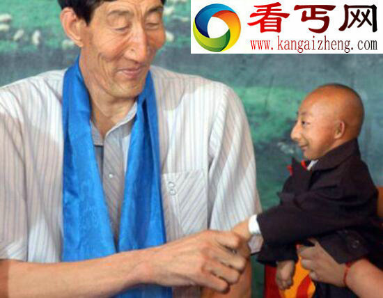 世界上最小的人，内蒙古人何平平（仅74.16厘米）