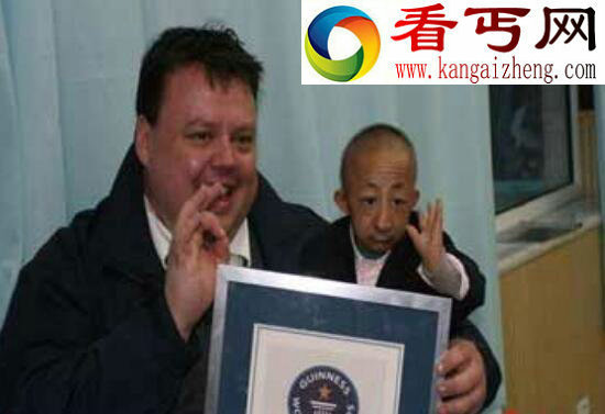 世界上最小的人，内蒙古人何平平（仅74.16厘米）