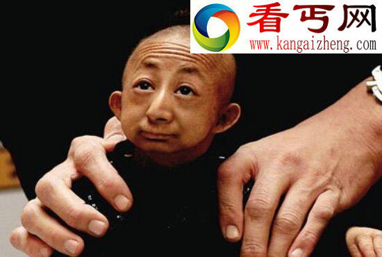 世界上最小的人，内蒙古人何平平（仅74.16厘米）