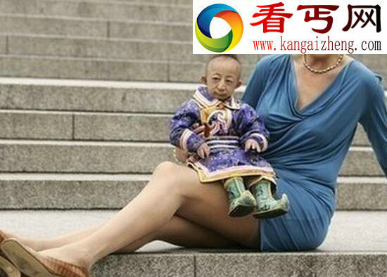 世界上最小的人，内蒙古人何平平（仅74.16厘米）
