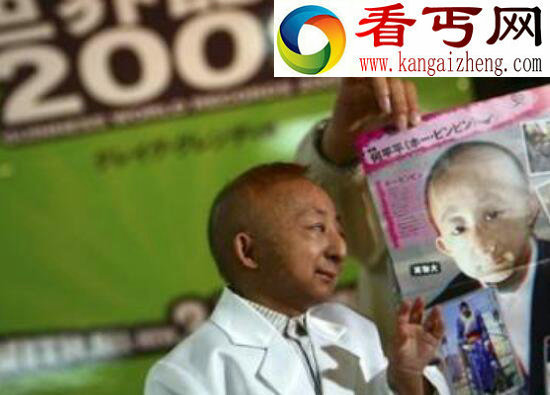 世界上最小的人，内蒙古人何平平（仅74.16厘米）
