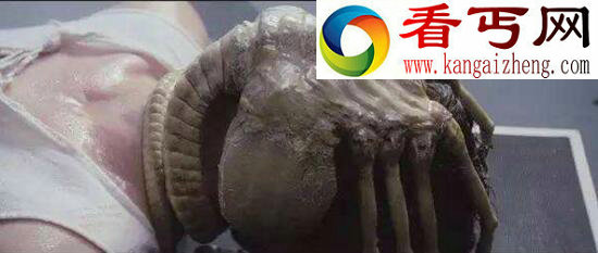 抱脸虫，将胚胎植入人体大脑（极度恶心）