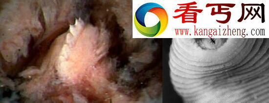 暴君水蛭,噬血杀人的水蛭之王(寄生霸王龙)