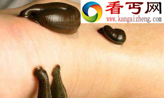 暴君水蛭,噬血杀人的水蛭之王(寄生霸王龙)