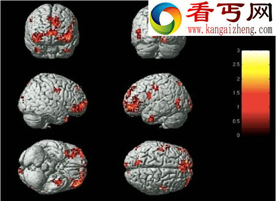 人的情绪可用大脑活动直接判断