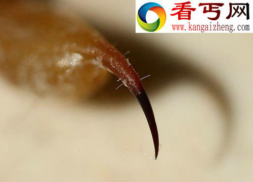 蝎子的毒素可帮助人们分辨癌细胞
