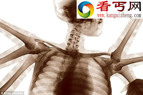 人类与动物的神秘杂交体