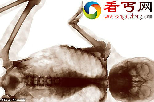 人类与动物的神秘杂交体