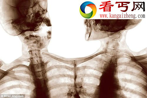 人类与动物的神秘杂交体