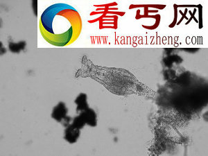 无性存活8000万年的蛭形轮虫有超过500种物种的基因