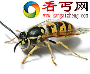 咬死你不偿命亲身体验发现十大蜇咬最疼痛昆虫