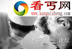 牛的基因转到人身上了？老妇头长“犄角”