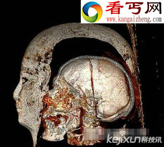 揭开古埃及木乃伊之谜 科学家用新鲜尸体制作木乃伊