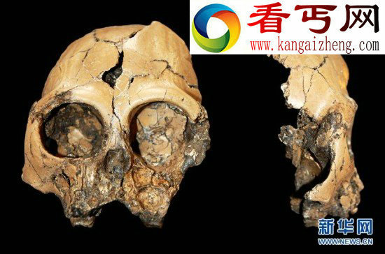 云南昭通发现600万年前古猿头骨化石