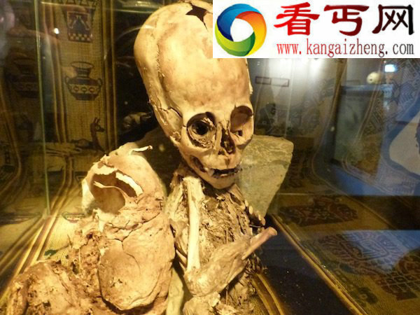 秘鲁出现神秘大头小身骨骸或是外星人