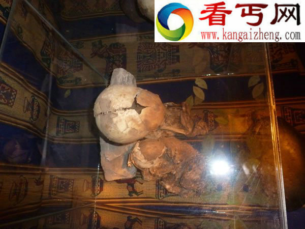 秘鲁出现神秘大头小身骨骸或是外星人