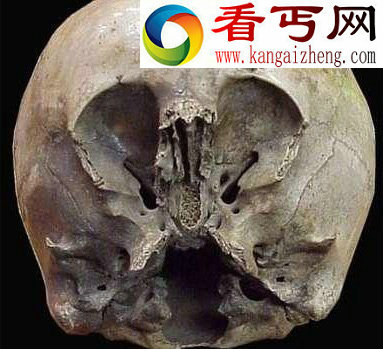 (图)墨西哥现怪异头骨疑为外星人和地球人混血儿