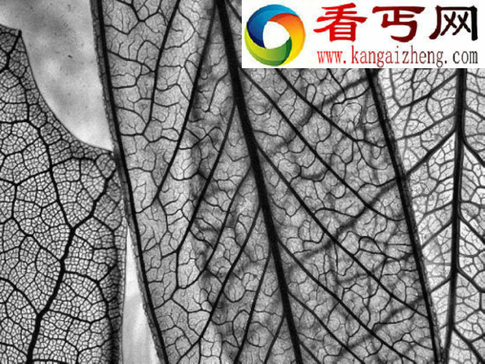 植物叶子为何千差万别？
