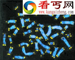 DNA片段能预知寿命？ “科学算命”褒贬不一