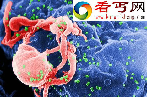 新艾滋疫苗可适应不断变异病毒明年临床试验