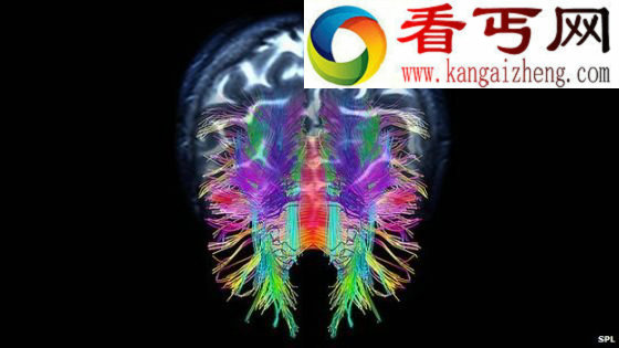 实验室造模拟大脑有基本自我意识(图)
