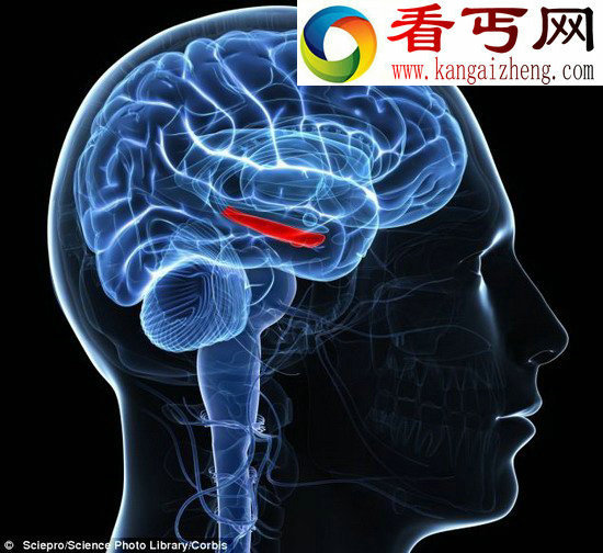 患者缺失记忆未来可通过植入器恢复