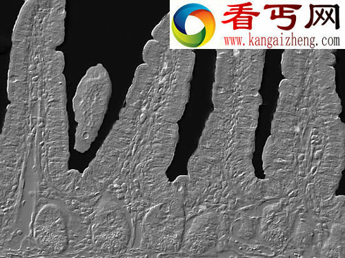 科学家摸清何以熬夜会影响免疫功能