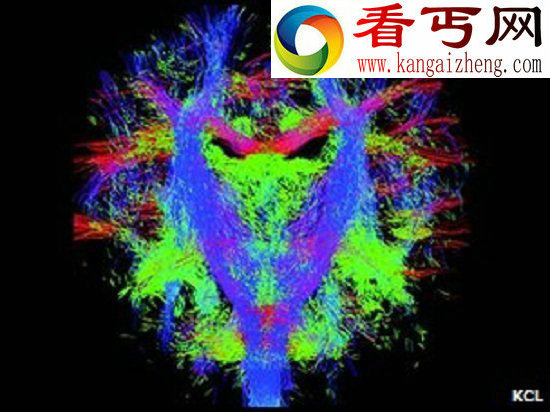 科学家对婴儿发育中的大脑进行绘图