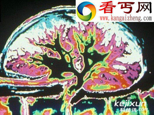 科学家培育能过滤血液产生尿液老鼠肾器官