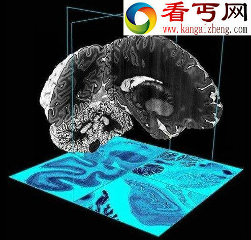 死亡大脑被切成7400片塑造3D模型/图 