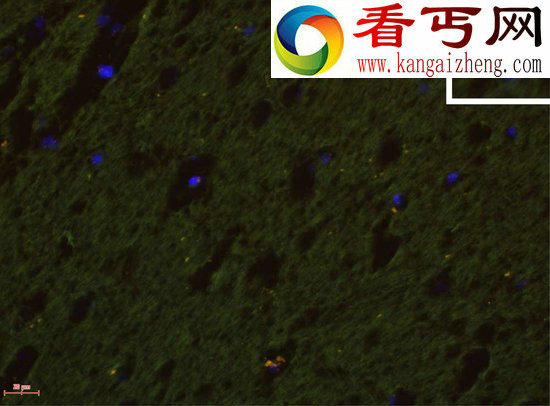 奇闻孕妇与胎儿存在细胞交换现象