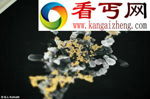 新发现“炼金菌” 吃“毒物”拉黄金 