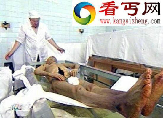 列宁遗体现状图片曝光，内脏血液被取出皮肉被代替