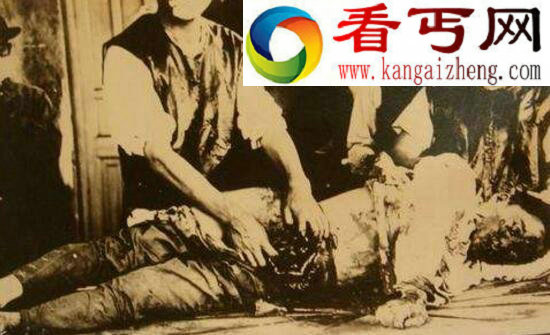731部队女子配种实验,女性被强行接种性病毒